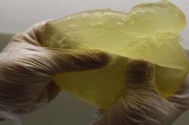 Les ruptures de prothèses PIP plus nombreuses que prévues